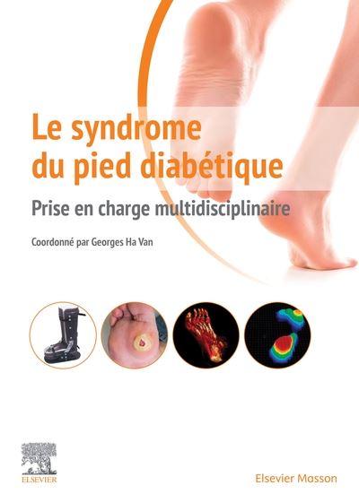 Le syndrome du pied diabétique Prise en charge multidisciplinaire