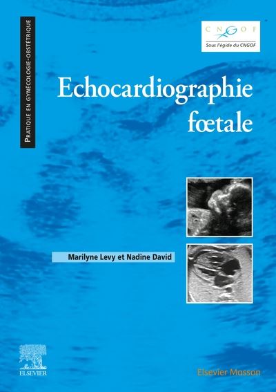 Echocardiographie foetale