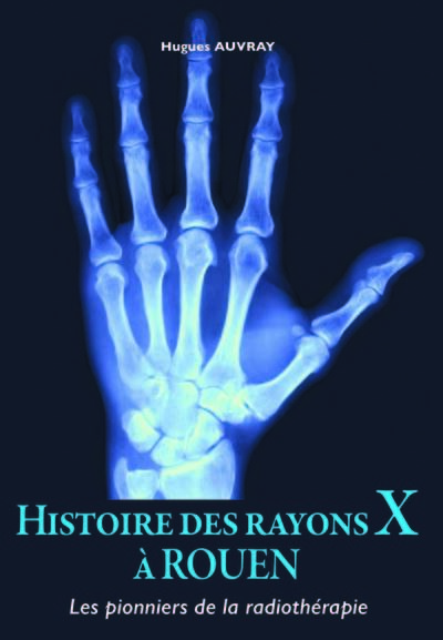 Histoire des rayons X à  Rouen Les pionniers de la radiothérapie